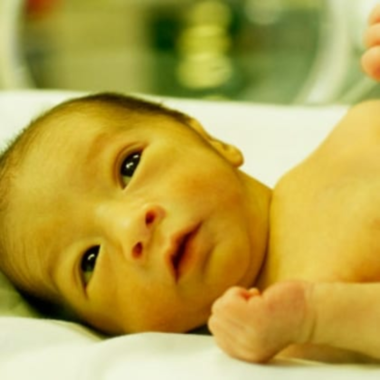 Bilirubin là nguyên nhân chính dẫn đến sự vàng da của trẻ