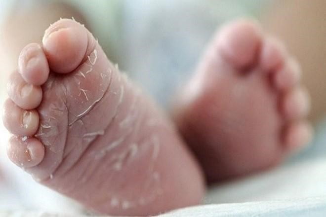 Da vùng bàn chân của con rất dễ bị khô