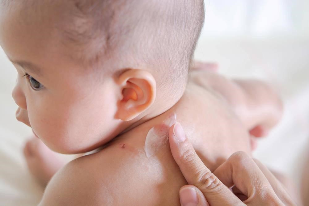 Lựa chọn kem dưỡng ẩm thích hợp với em bé để sử dụng cho con