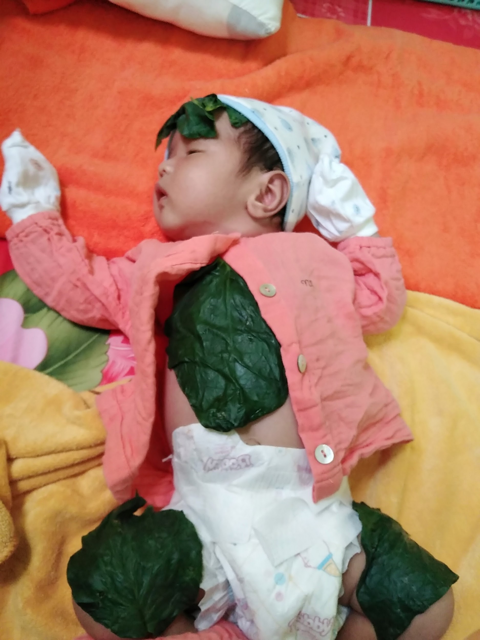 Nguyên nhân bé bị hăm tả
